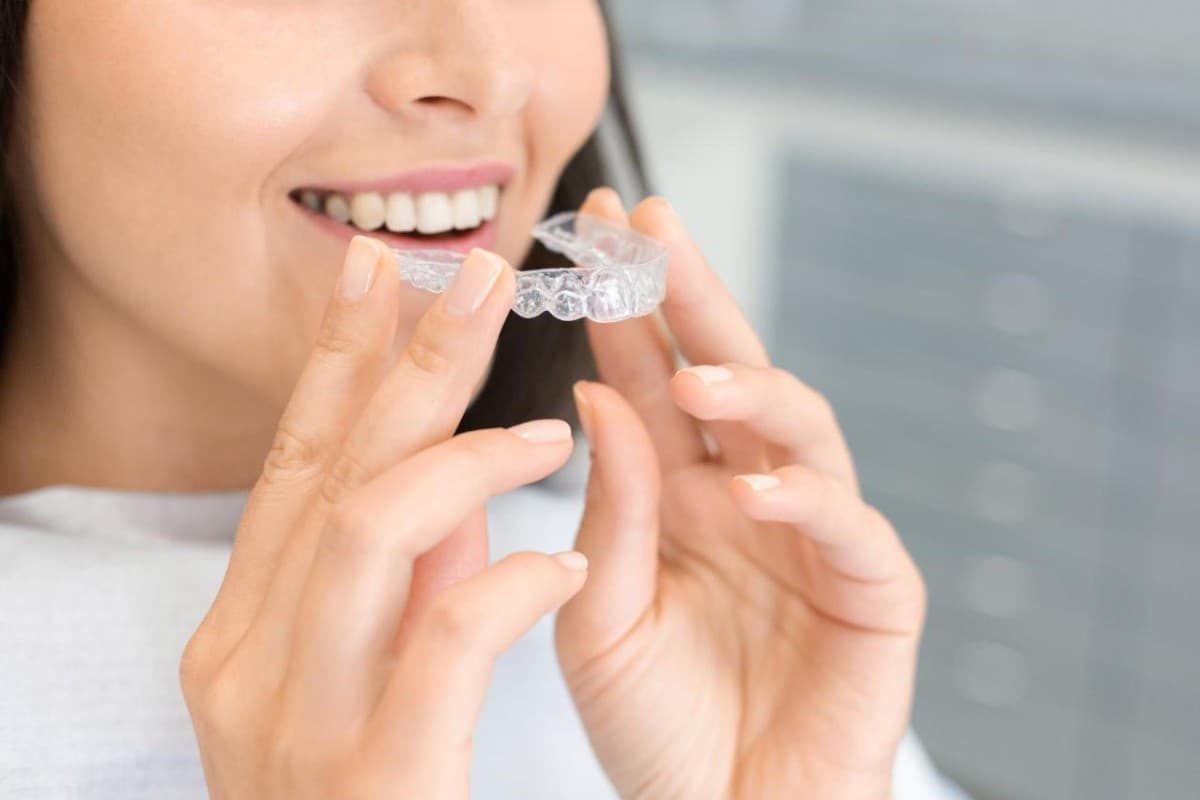 Braces vs. Clear Aligners: What Meriden, CT Patients Should Know